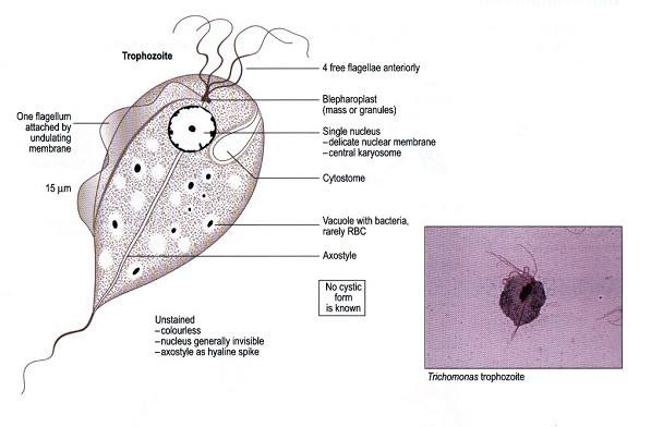 Trùng roi Trichomonas là "thủ phạm" gây viêm âm đạo, khiến khí hư có màu xanh