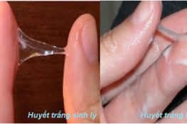 Nhận biết huyết trắng sinh lý và huyết trắng bệnh lý