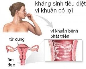 Viêm nấm âm đạo cho tạp khuẩn