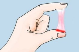 Huyết trắng lẫn máu - Nguyên nhân do đâu?