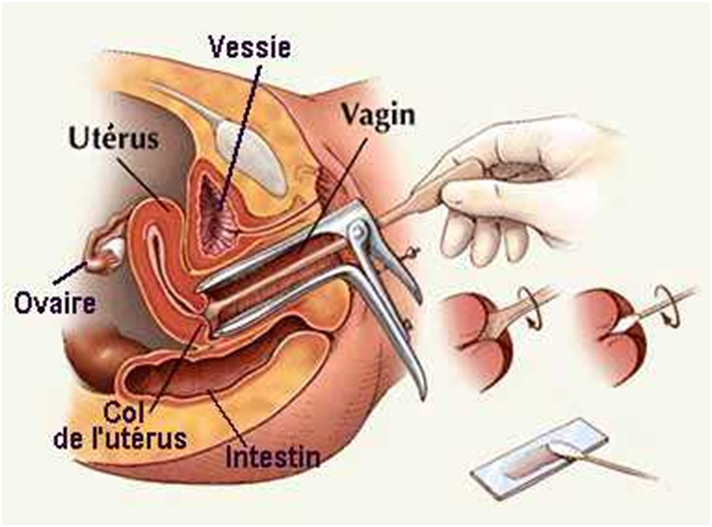 Cần Gấp Kham Phụ Khoa Bằng Mỏ Vịt Co đau Khong