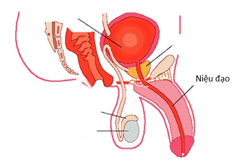 Viêm niệu đạo là hiện tượng đoạn nối giữa bàng quang và lỗ tiểu bị viêm nhiễm