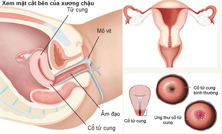 Cấu tạo cổ tử cung