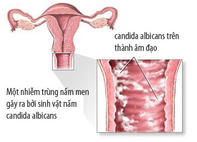 nguyên nhân khiến vùng kín có mùi và ngứa