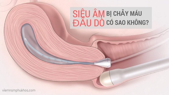 Siêu âm đầu dò bị chảy máu có sao không?