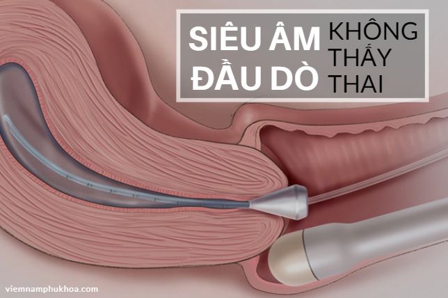 Vì sao siêu âm đầu dò không thấy thai?