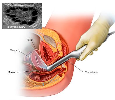 Siêu âm đầu dò có thể giúp phát hiện một số vấn đề bất thường