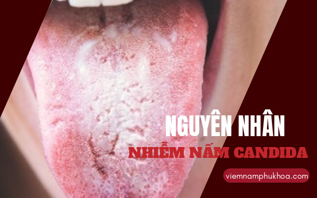 nguyên nhân gây nấm candida