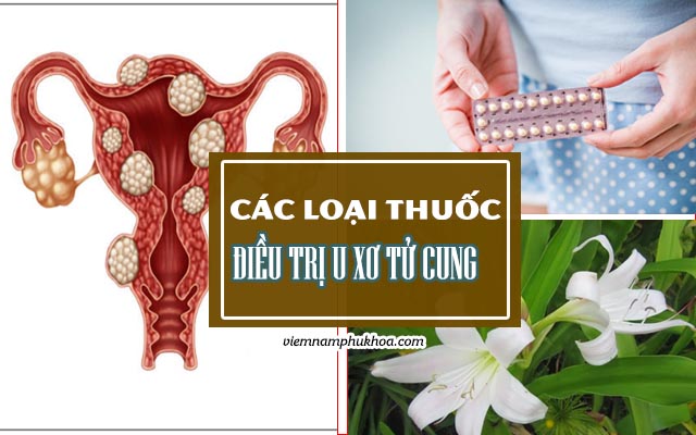 Các loại thuốc chữa u xơ tử cung