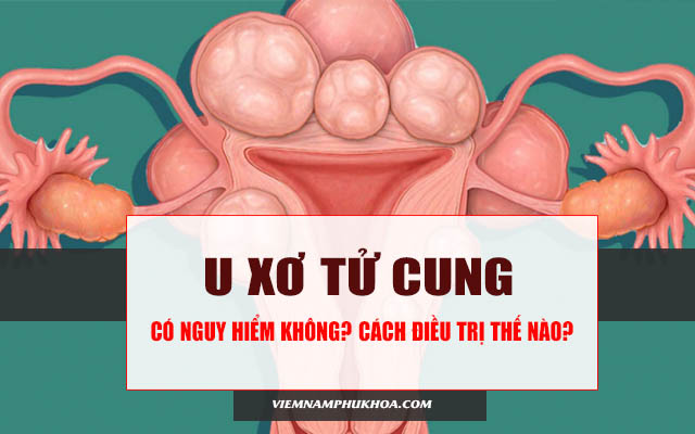 u xơ tử cung có nguy hiểm không và điều trị như thế nào