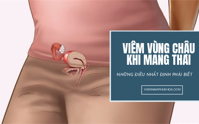 viêm vùng chậu khi mang thai