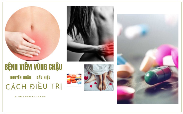 thông tin về bệnh viêm vùng chậu