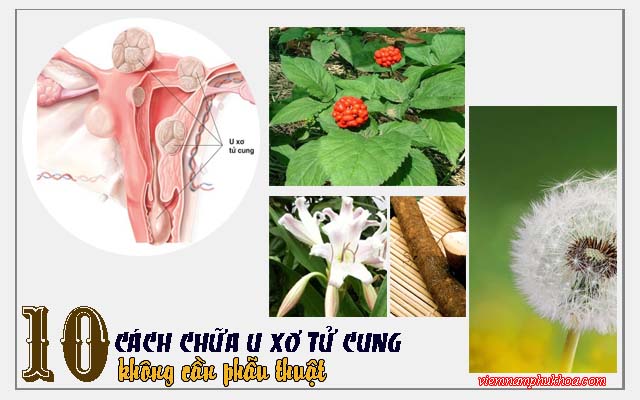 cách chữa u xơ tử cung