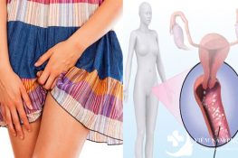 Có nên sử dụng phụ khang đỗ minh chữa nấm âm đạo