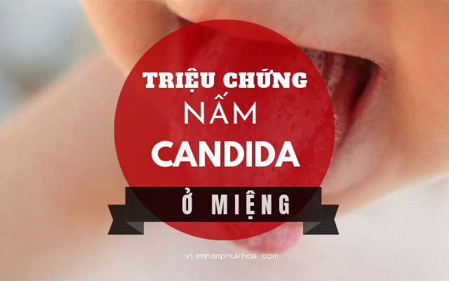 triệu chứng nấm candida ở miệng