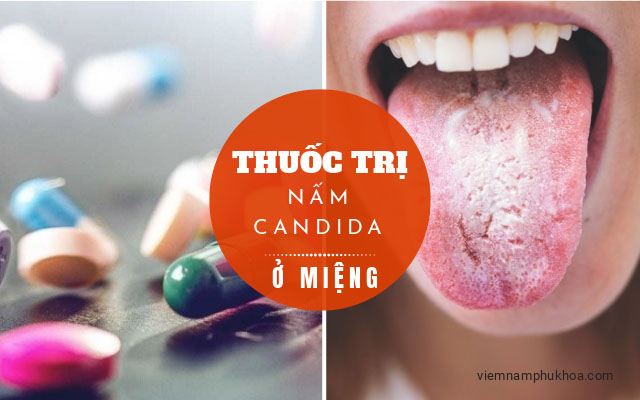 thuốc trị nấm Candida ở miệng
