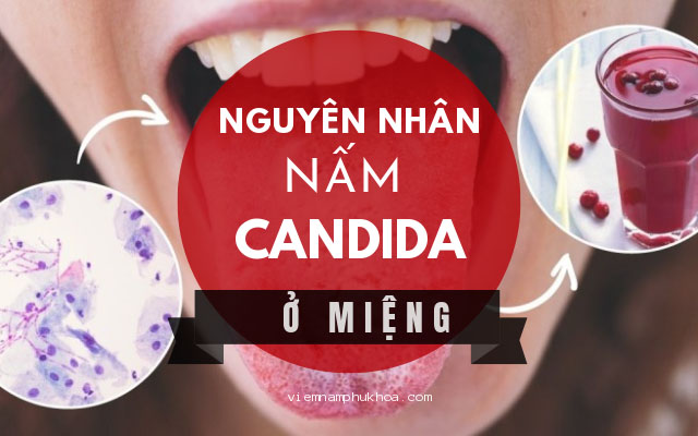 Nguyên nhân gây nấm Candida ở miệng