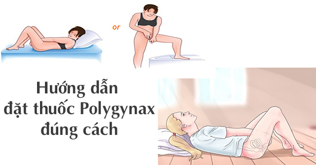 Hướng dẫn cách đặt thuốc đúng