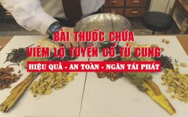 Bài thuốc chữa viêm lộ tuyến cổ tử cung của Bác sĩ Thụy có hiệu quả kéo dài, ngăn tái phát