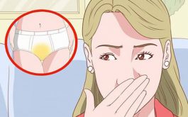 Khí hư ra nhiều, có mùi hôi thường là biểu hiện của viêm nhiễm Phụ khoa
