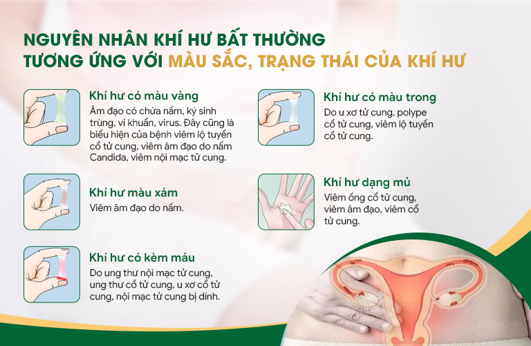 Khí hư ra nhiều, có mùi hôi thường là biểu hiện của viêm nhiễm Phụ khoa