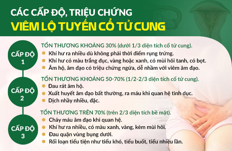 Các cấp độ viêm lộ tuyến cổ tử cung và triệu chứng điển hình