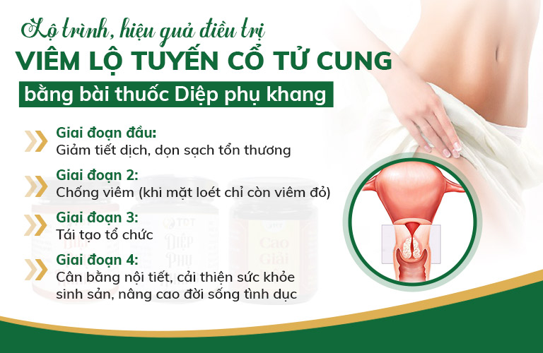 Lộ trinh điều trị viêm lộ tuyến cổ tử cung, giúp phục hồi chức năng tử cung mà không cần diệt tuyến