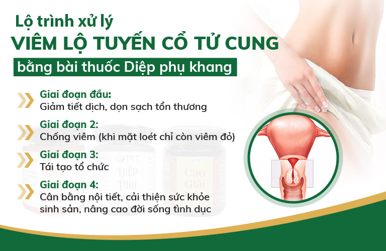 Lộ trình thoát bệnh viêm lộ tuyến với Diệp Phụ Khang