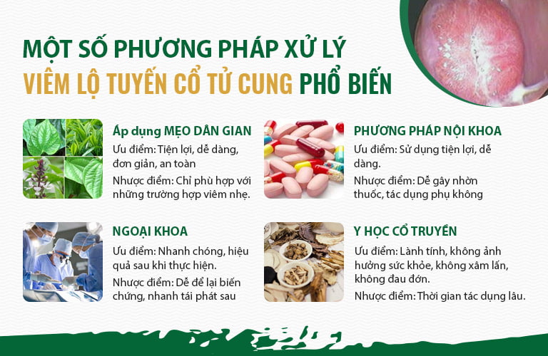 Các phương pháp xử lý viêm lộ tuyến phổ biến Các phương pháp xử lý viêm lộ tuyến phổ biến