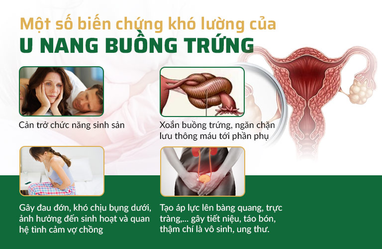 U nang buồng trứng không đơn giản như chị em vẫn tưởng