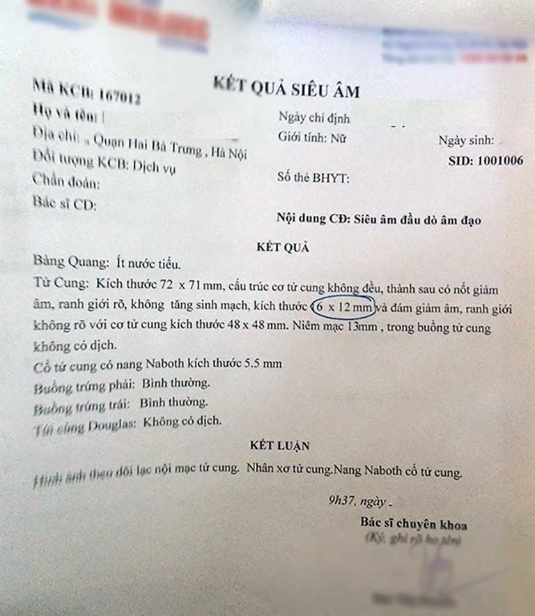 Bệnh nhân giảm kích thước khối u xơ tử cung sau khi điều trị với bài thuốc Diệp Phụ Khang