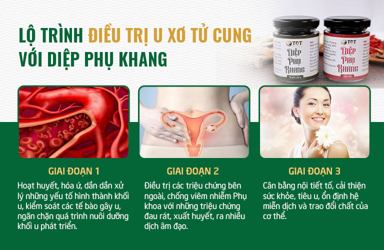 Bệnh nhân được hướng dẫn sử dụng Diệp Phụ Khang chữa u xơ tử cung theo lộ trình cụ thể, đảm bảo hiệu quả theo từng giai đoạn