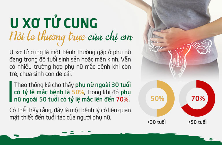 U xơ tử cung là bệnh lý phổ biến nhưng cũng là bệnh lý mà chị em phụ nữ tỏ ra rất chủ quan khi đối mặt