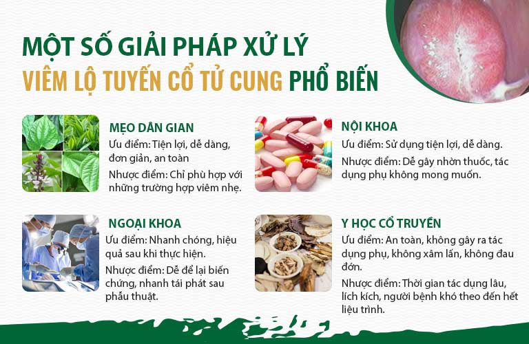 Ưu nhược điểm của phương pháp xử lý viêm lộ tuyến phổ biến