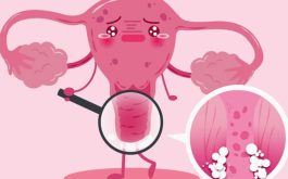 Viêm âm đạo có thể khiến chị em gặp nhiều phiền toái dai dẳng